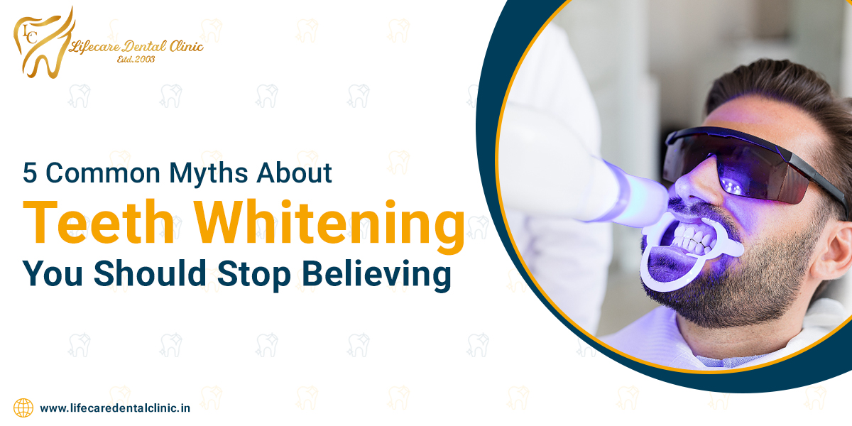 5-Common-Myths-About-Teeth-Whitening-You-Should-Stop-Believing