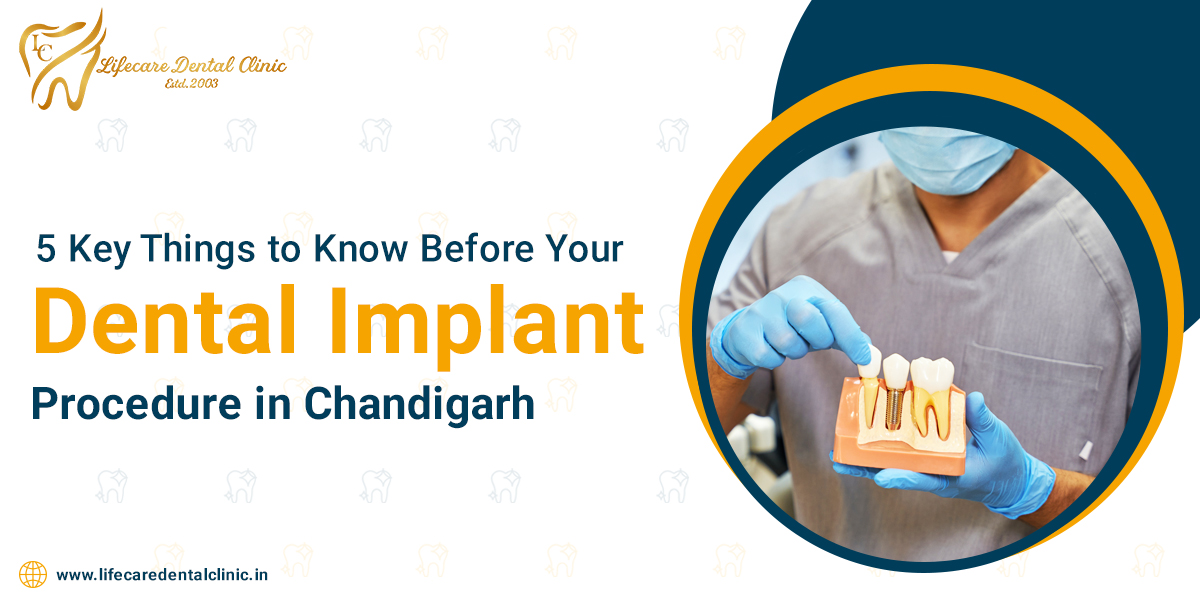 5-Key-Things-to-Know-Before-Your-Dental-Implant-Procedure-in-Chandigarh