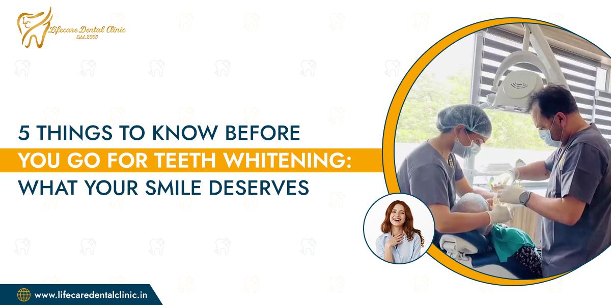 5-Things-to-Know-Before-You-Go-for-Teeth-Whitening-What-Your-Smile-Deserves