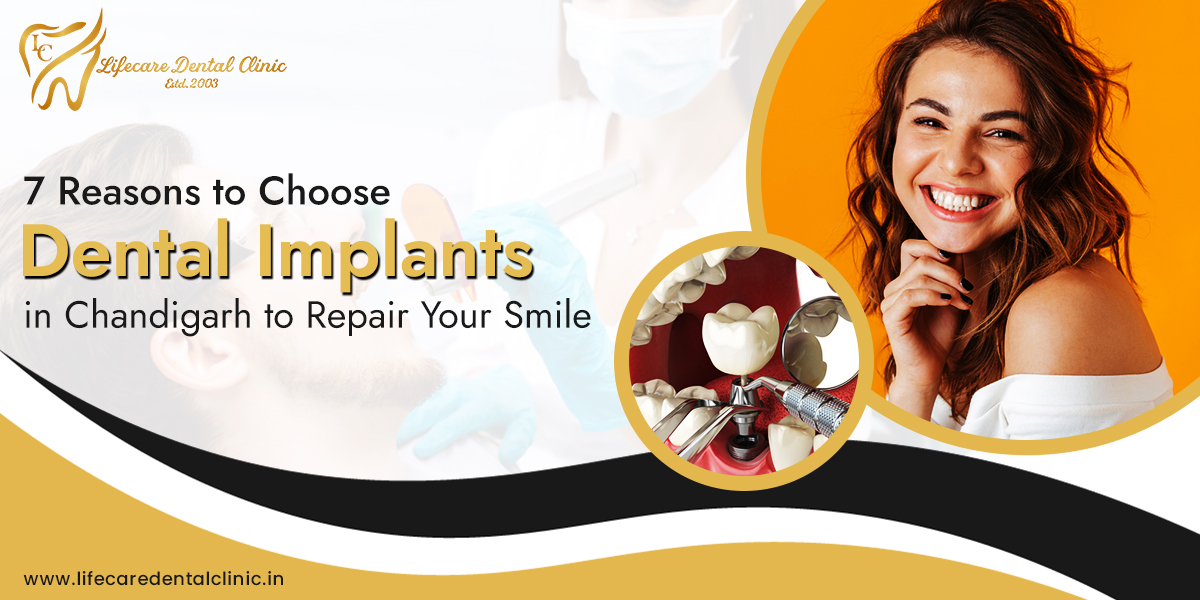 7-Reasons-to-Choose-Dental-Implants-in-Chandigarh-to-Repair-Your-Smile