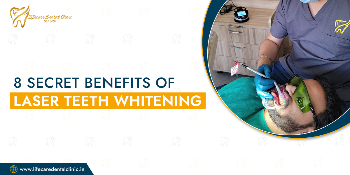 8-Secret-Benefits-of-Laser-Teeth-Whitening