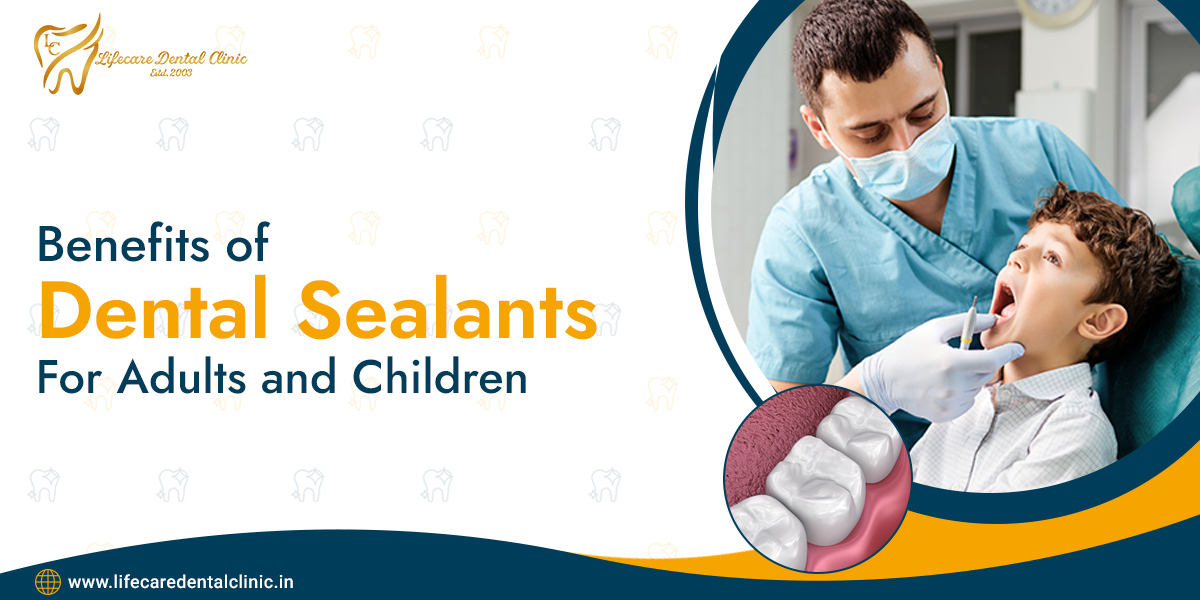 Benefits-Of-Dental-Sealants-For-Your-Child