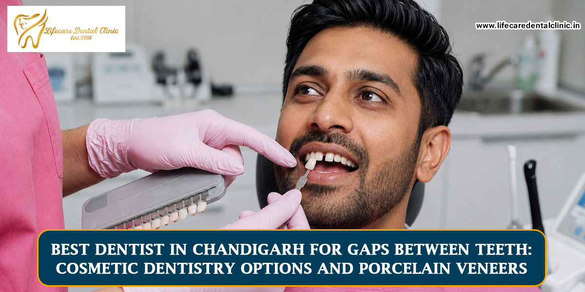 Best-Dentist-in-Chandigarh-for-Gaps-Between-Teeth