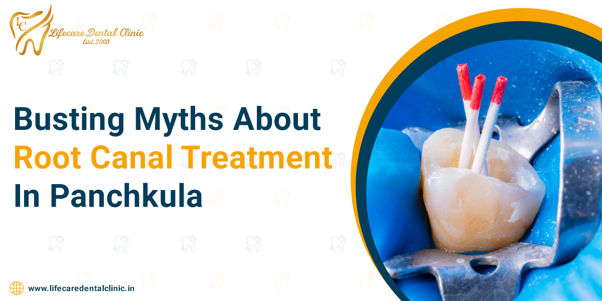 Busting-Myths-About-Root-Canal-Treatment-In-Panchkula