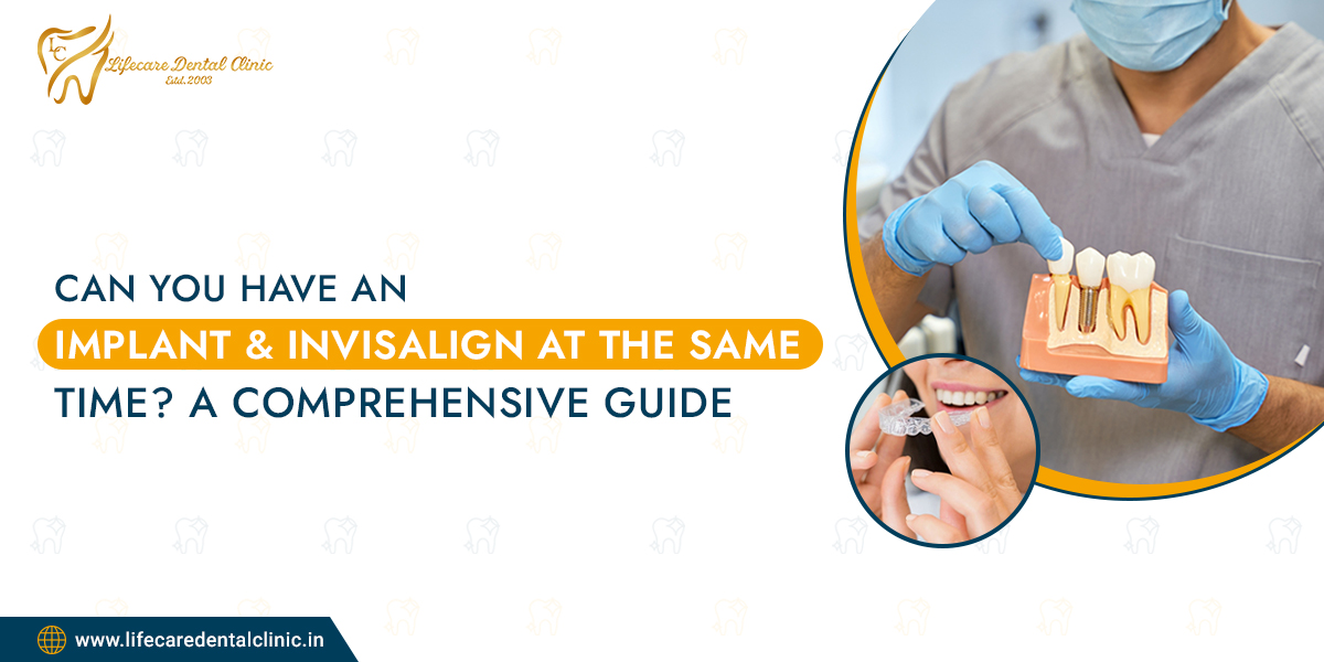 Can-You-Have-an-Implant-and-Invisalign-at-the-Same-Time-A-Comprehensive-Guide