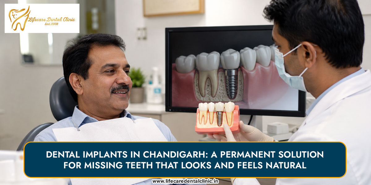 Dental-Implants-in-Chandigarh
