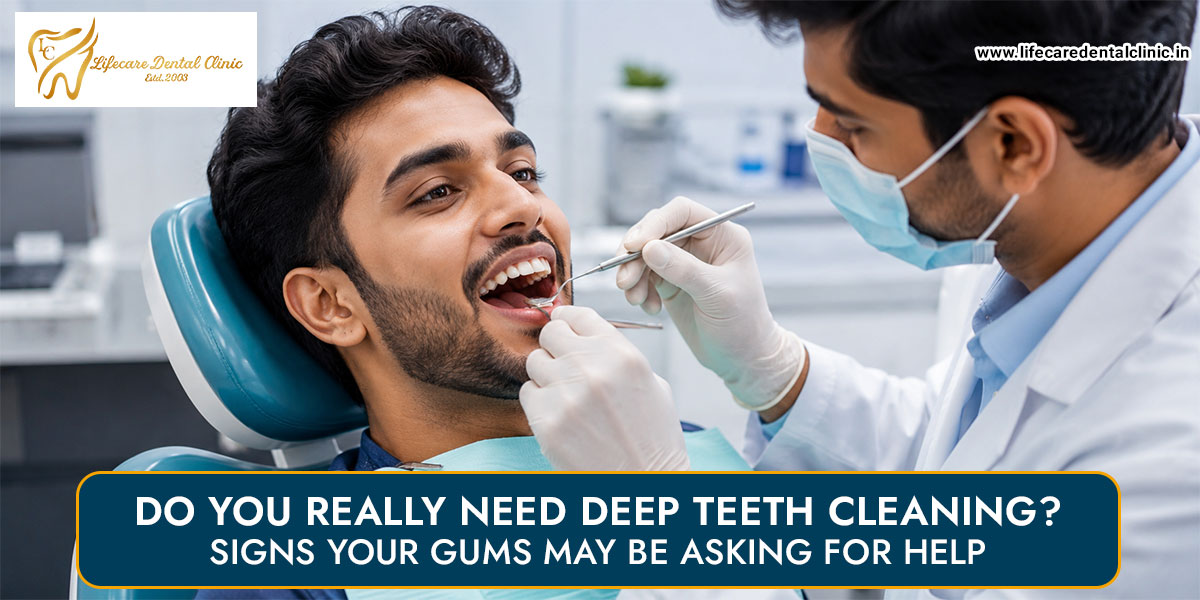 Do-You-Really-Need-Deep-Teeth-Cleaning