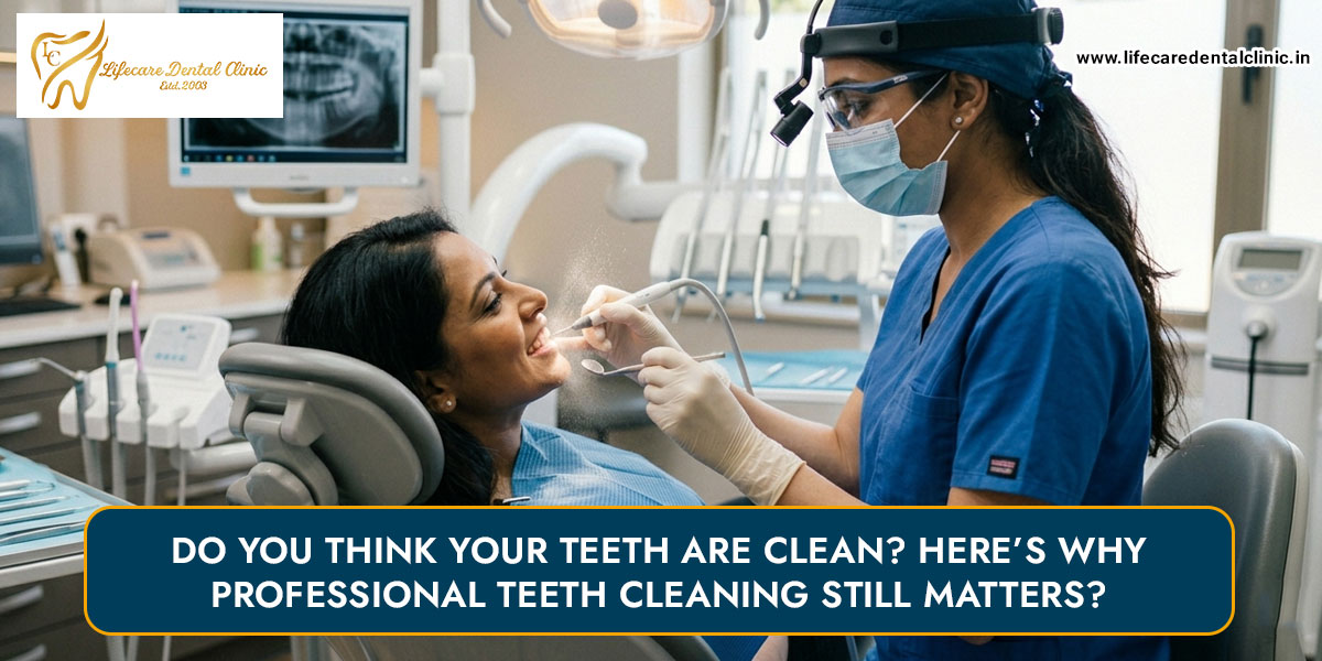 Do-You-Think-Your-Teeth-Are-Clean