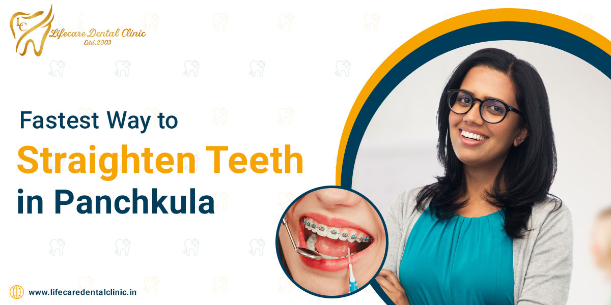 Fastest-Way-to-Straighten-Teeth-in-Panchkula