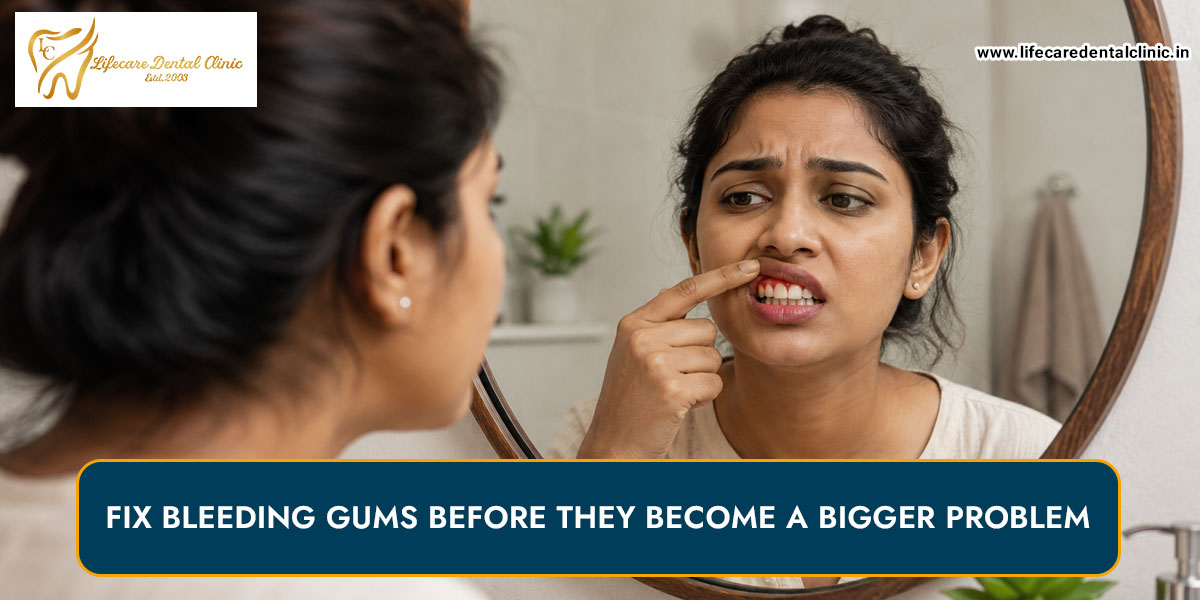 Fix-Bleeding-Gums-Before-They-Become-a-Bigger-Problem