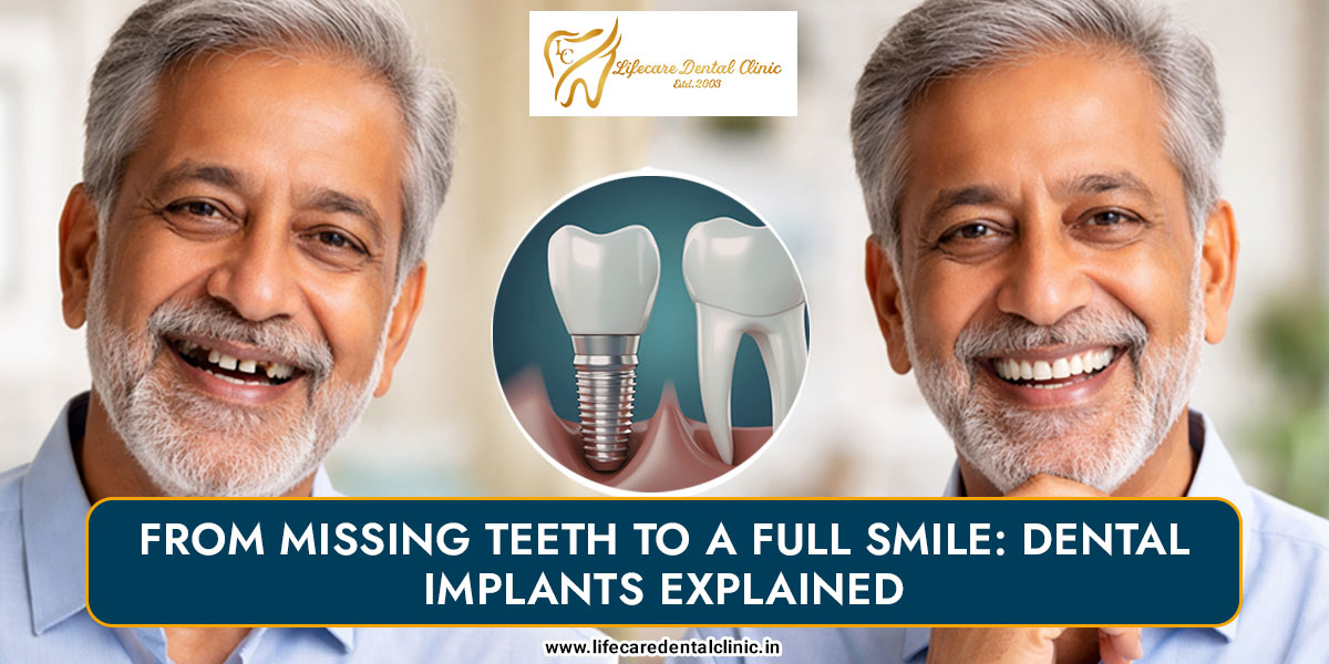 From-Missing-Teeth-to-a-Full-Smile1