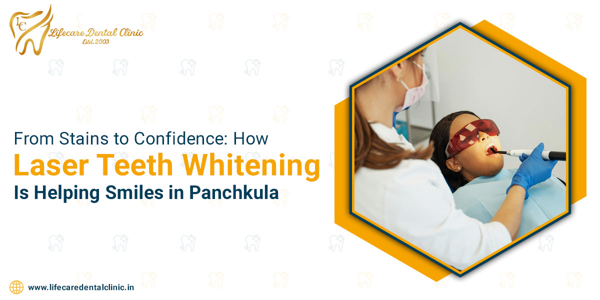 From-Stains-to-Confidence-How-Laser-Teeth-Whitening-Is-Helping-Smiles-in-Panchkula
