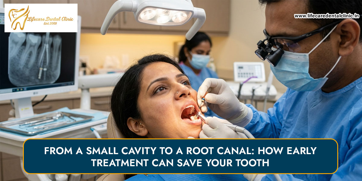 From-a-Small-Cavity-to-a-Root-Canal