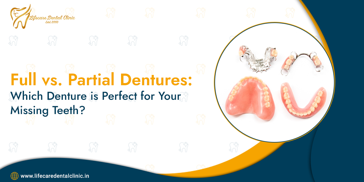 Full-vs--Partial-Dentures-Which-Denture-is-Perfect-for-Your-Missing-Teeth
