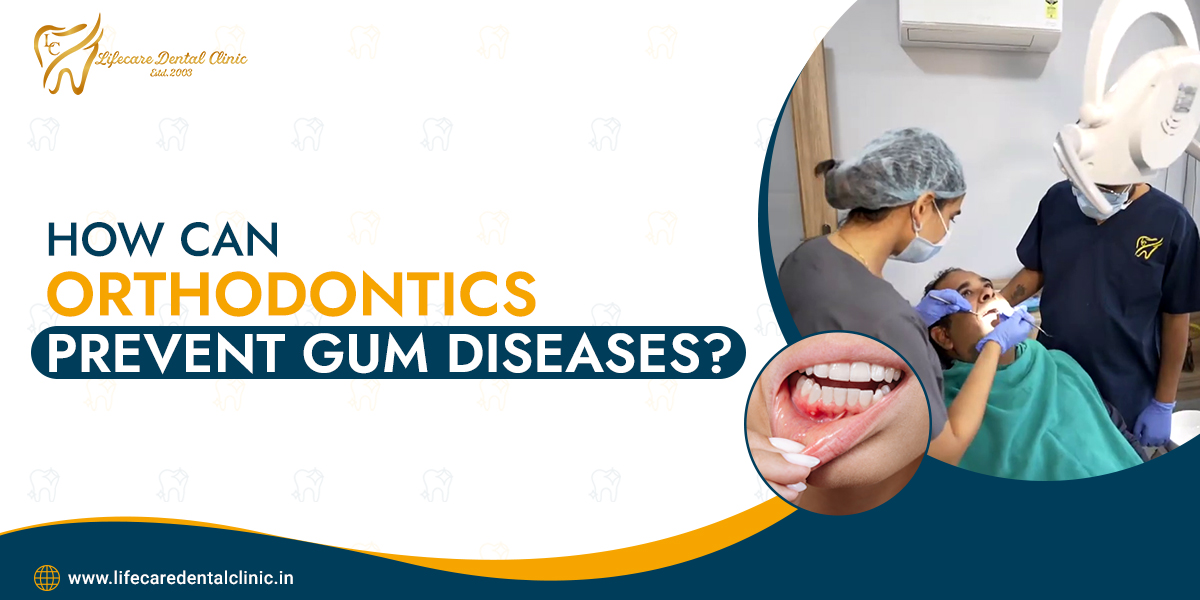 How-Can-Orthodontics-Prevent-Gum-Diseases