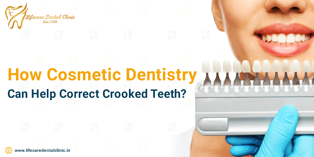 How-Cosmetic-Dentistry-Can-Help-Correct-Crooked-Teeth