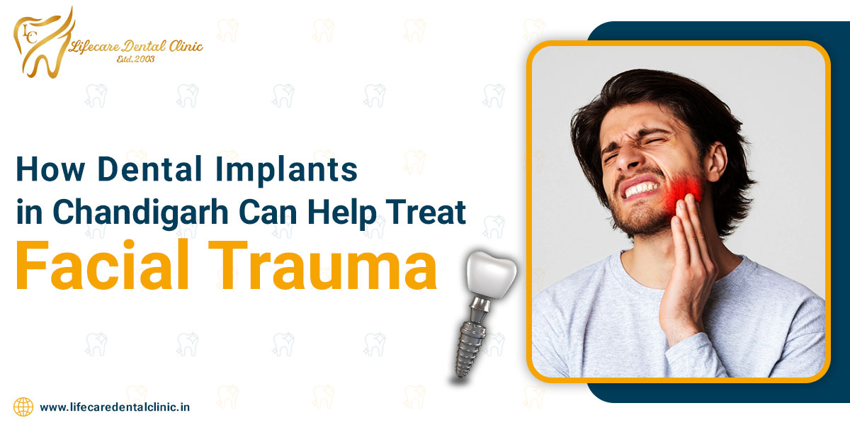 How-Dental-Implants-in-Chandigarh-Can-Help-Treat-Facial-Trauma