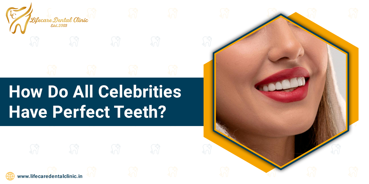 How-Do-All-Celebrities-Have-Perfect-Teeth