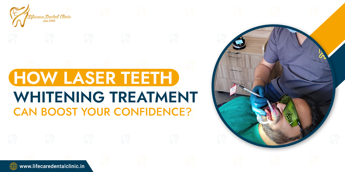 How-Laser-Teeth-Whitening-Treatment-Can-Boost-Your-Confidence