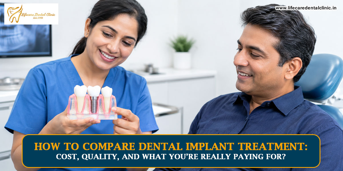 How-to-Compare-Dental-Implant-Treatment
