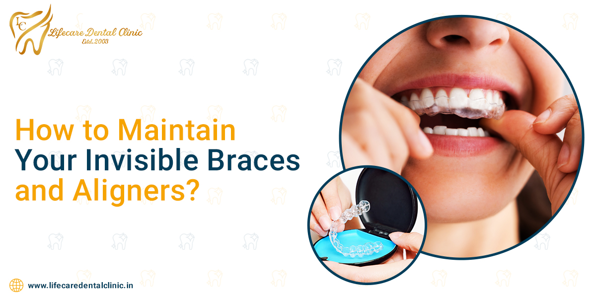 How-to-Maintain-Your-Invisible-Braces-and-Aligners