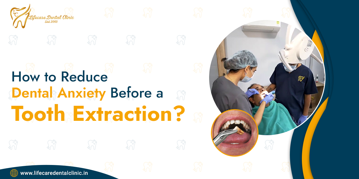 How-to-Reduce-Dental-Anxiety-Before-a-Tooth-Extraction