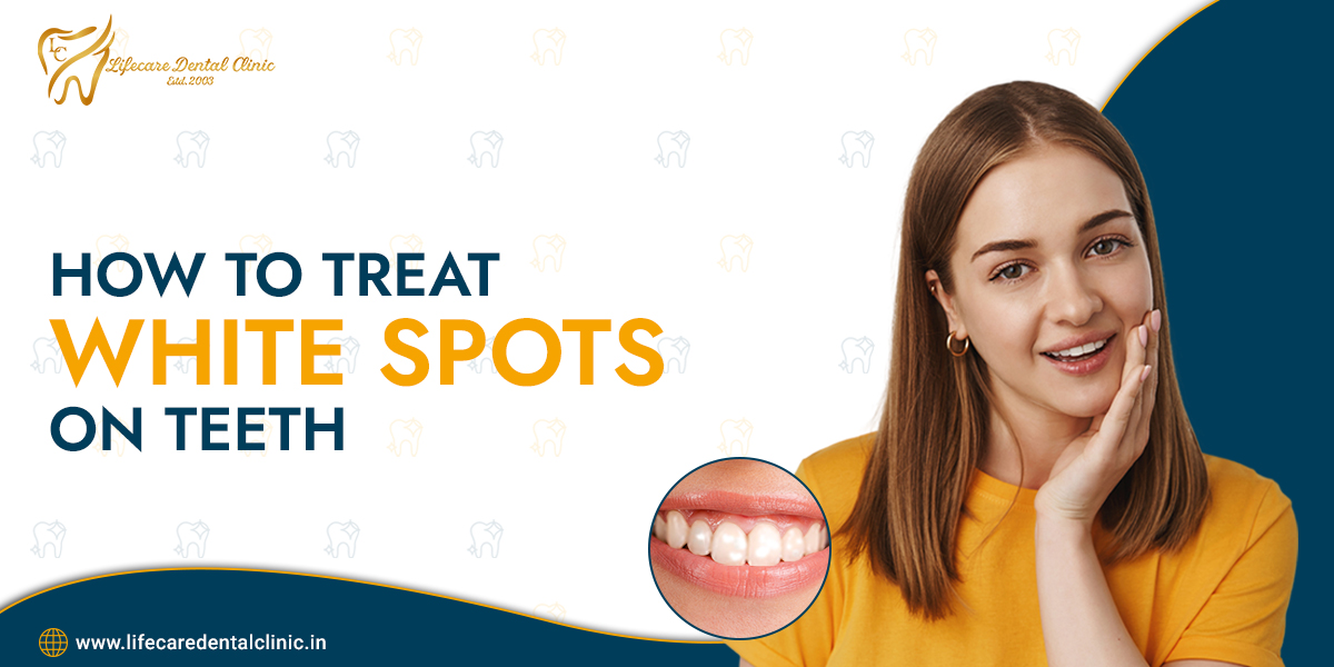 How-to-Treat-White-Spots-on-Teeth2