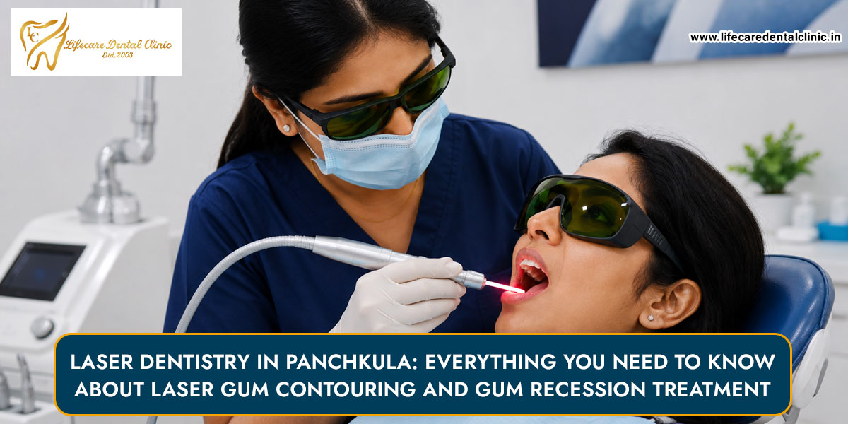 Laser-Dentistry-in-Panchkula