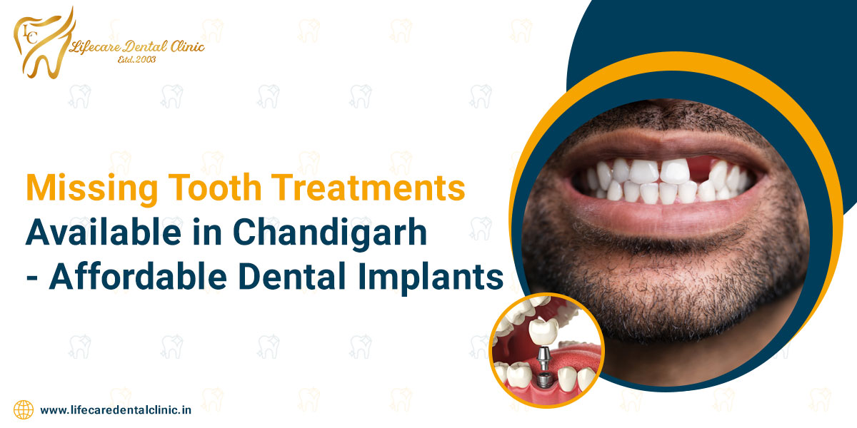 Missing-tooth-treatments-available-in-Chandigarh---Affordable-dental-implants