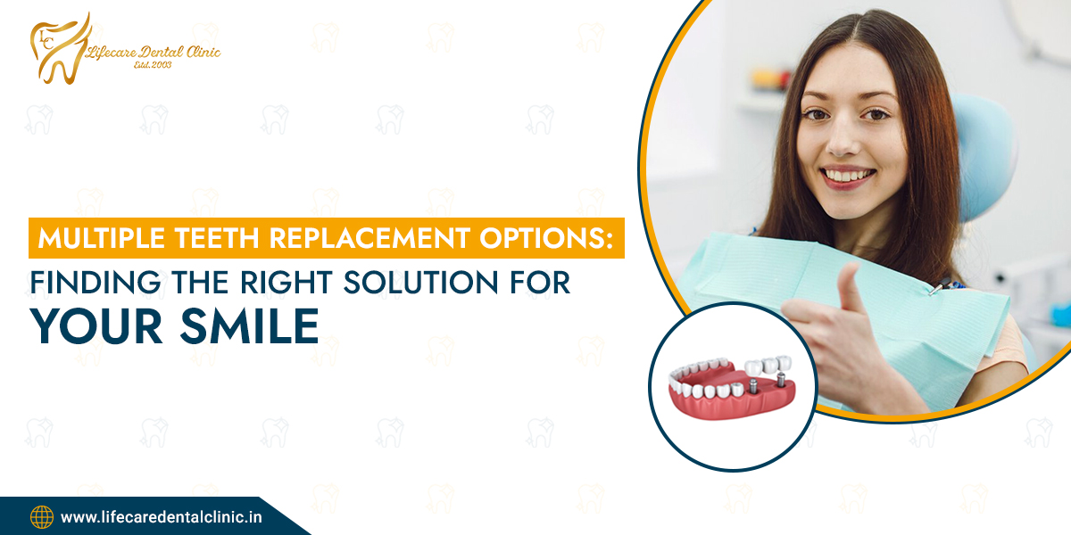 Multiple-Teeth-Replacement-Options-Finding-the-Right-Solution-for-Your-Smile