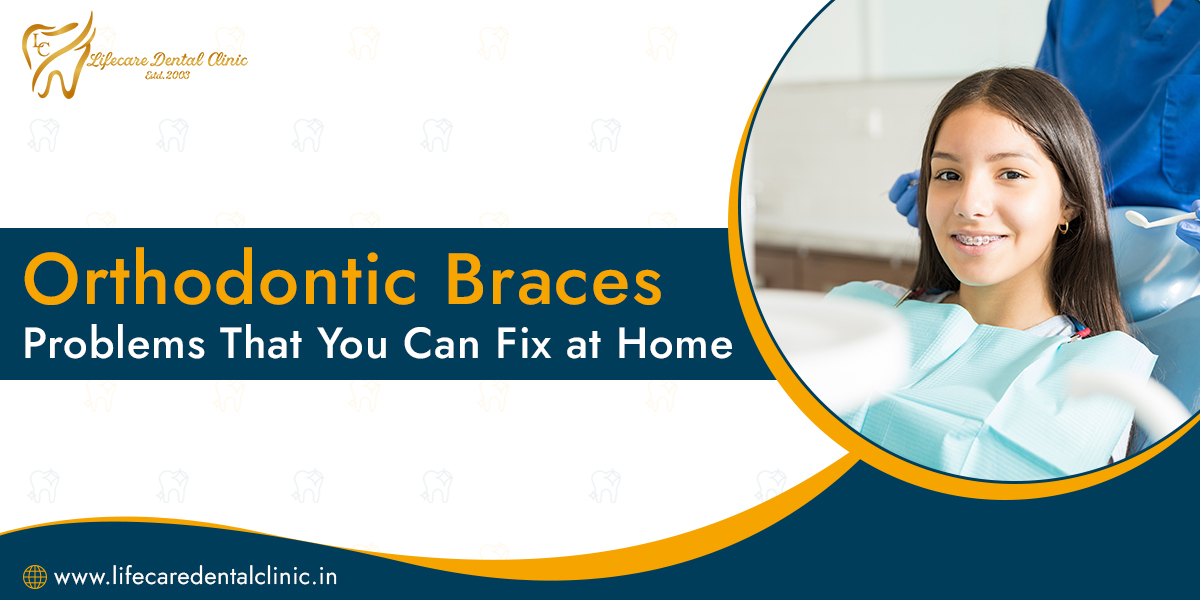 Orthodontic-Braces-Problems-That-You-Can-Fix-at-Home