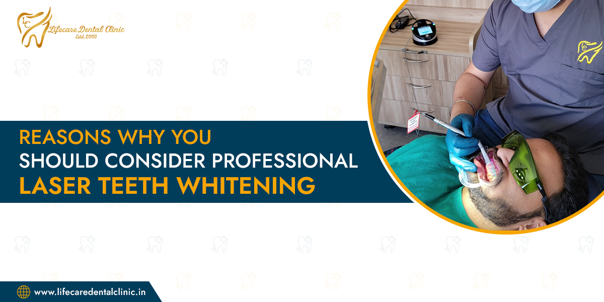 Reasons-Why-You-Should-Consider-Professional-Laser-Teeth-Whitening