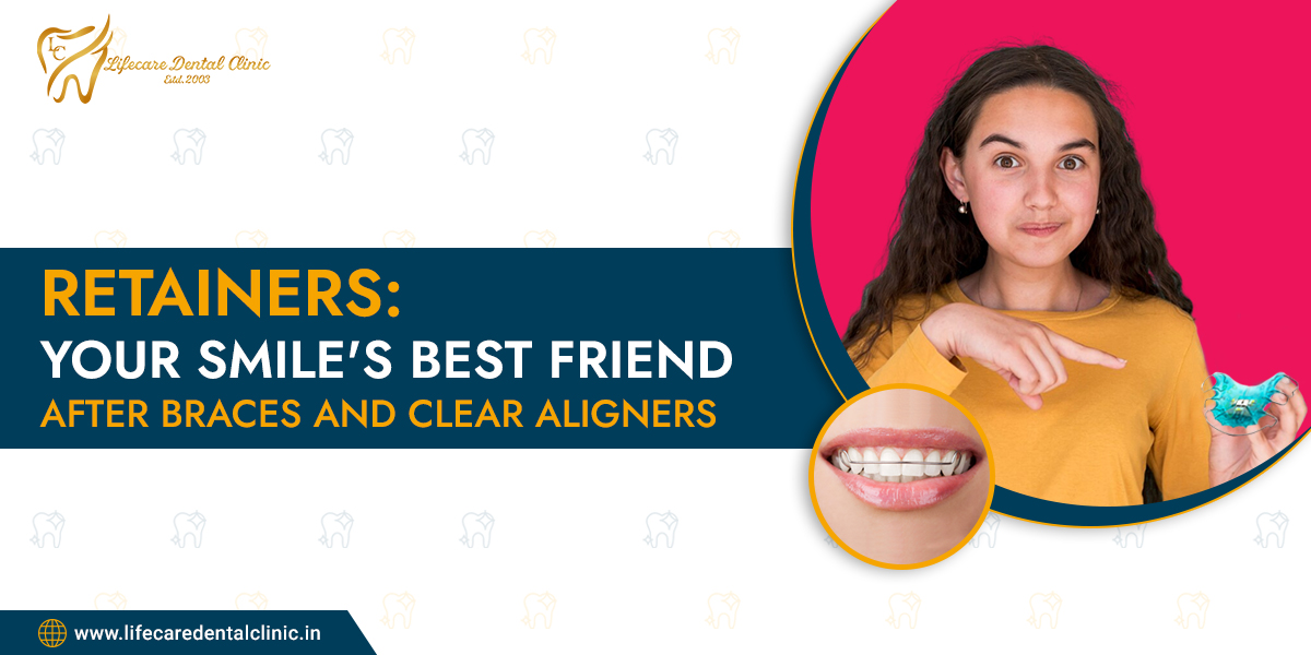 Retainers-Your-Smiles-Best-Friend-After-Braces-and-Clear-Aligners1