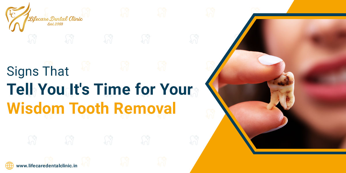 Signs-That-Tell-You-It's-Time-for-Your-Wisdom-Tooth-Removal