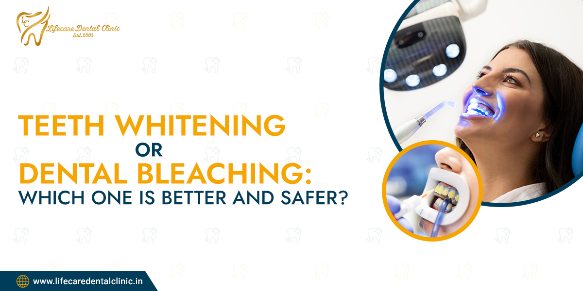 Teeth-Whitening-or-Bleaching-Which-One-is-Better-and-Safer