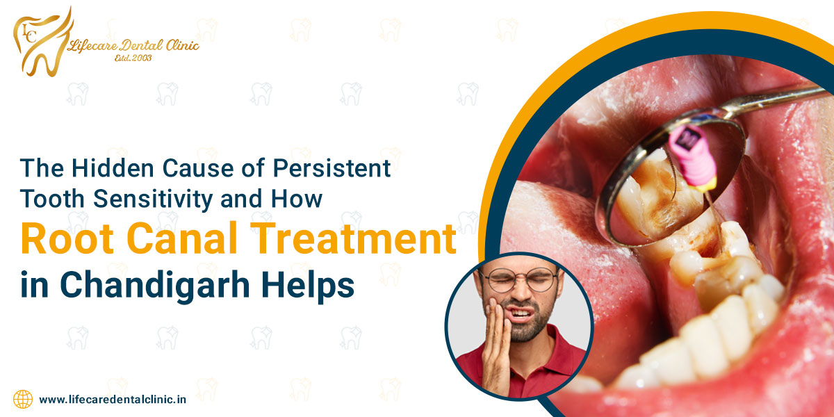 The-Hidden-Cause-of-Persistent-Tooth-Sensitivity-and-How-Root-Canal-Treatm