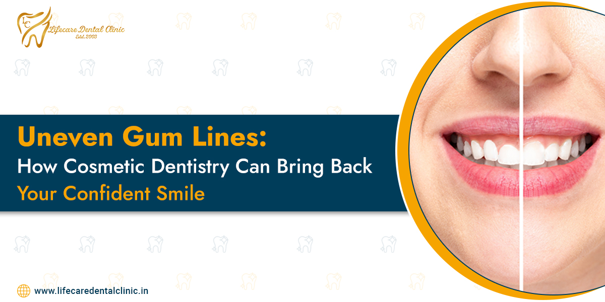 Uneven-Gum-Lines--How-Cosmetic-Dentistry-Can-Bring-Back-Your-Confident-Smile