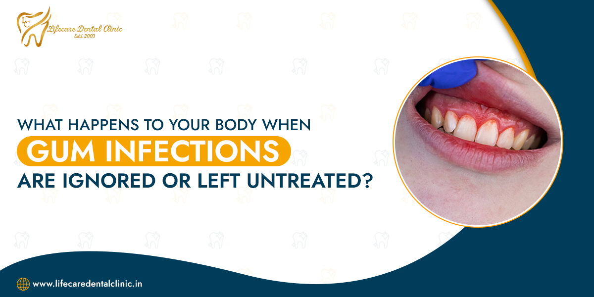 What-happens-to-your-body-when-gum-infections-are-ignored-or-left-untreated1