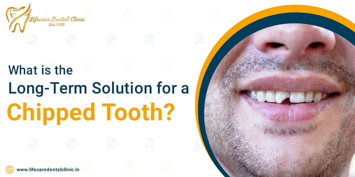 What-is-a-Long-Term-Solution-for-Chipped-Tooth