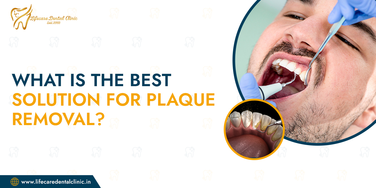 What-is-the-Best-Solution-for-Plaque-Removal