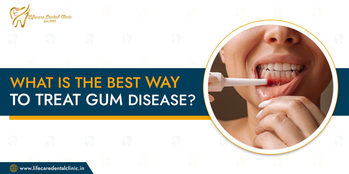 What-is-the-Best-Way-to-Treat-Gum-Disease