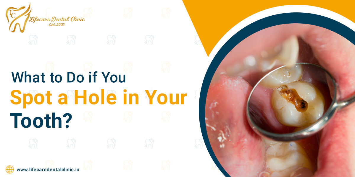 What-to-Do-if-You-Spot-a-Hole-in-Your-Tooth