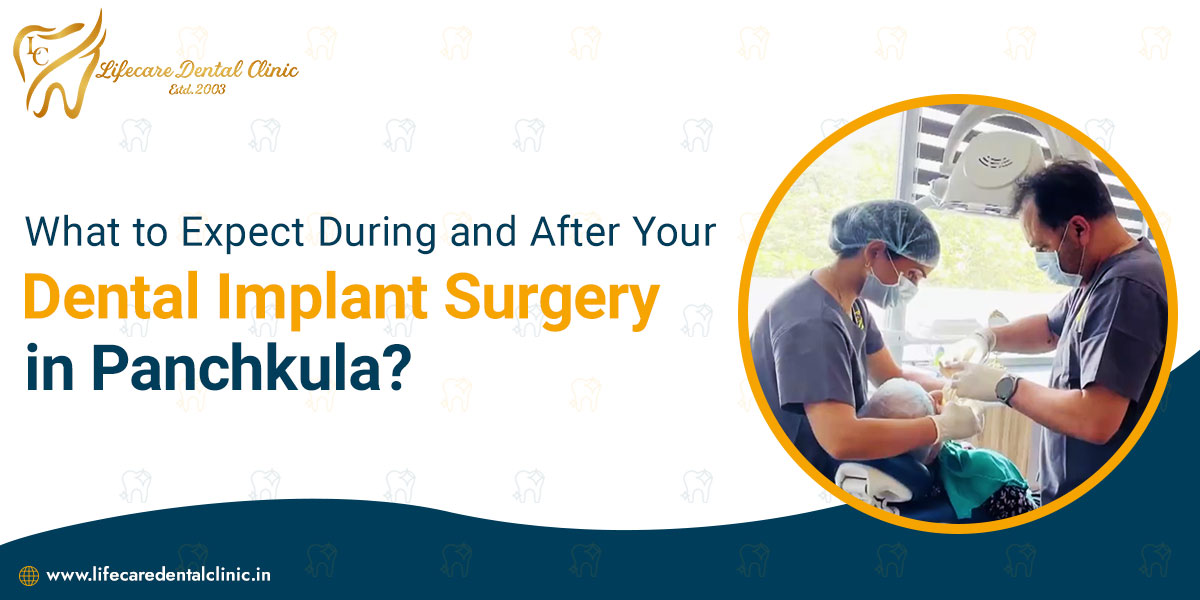 What-to-Expect-During-and-After-Your-Dental-Implant-Surgery-in-Panchkula
