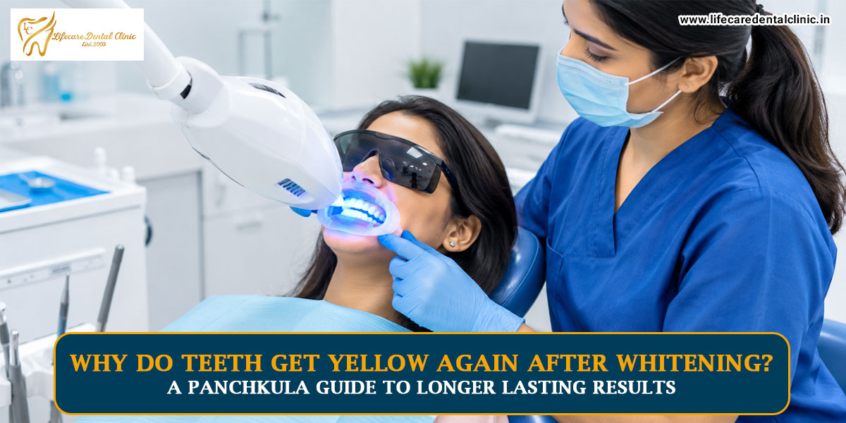 Why-Do-Teeth-Get-Yellow-Again-After-Whitening