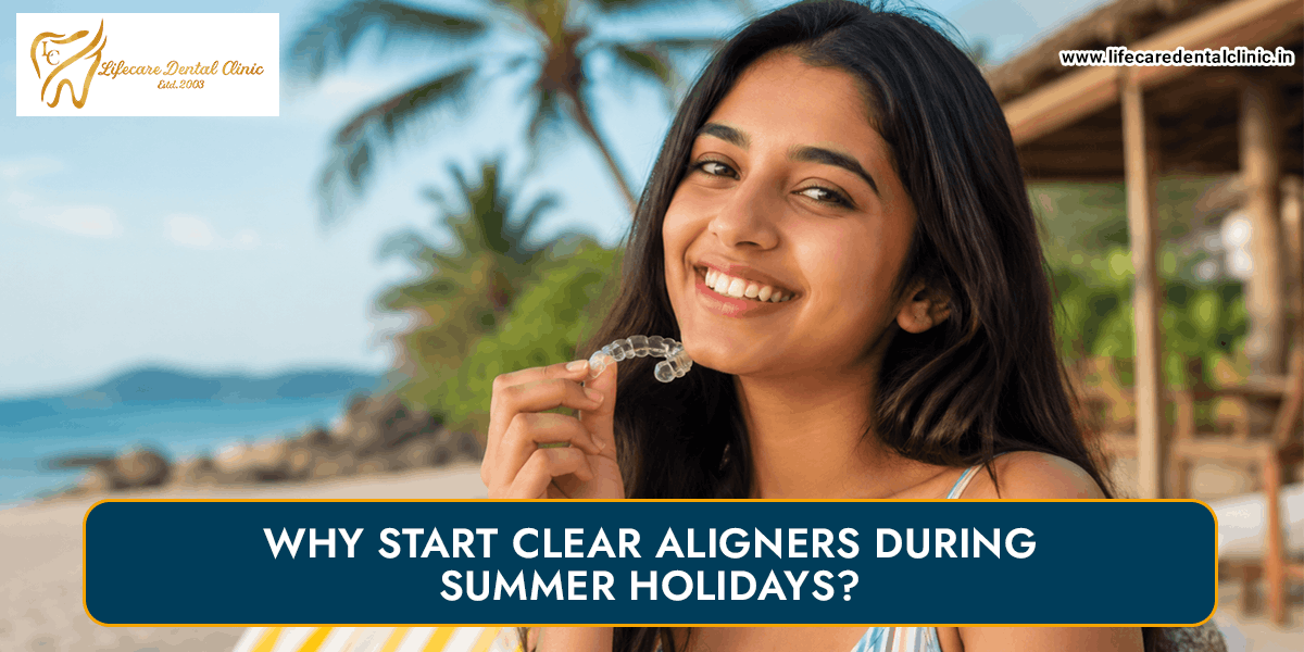 Why-Start-Clear-Aligners-During-Summer-Holidays(1)