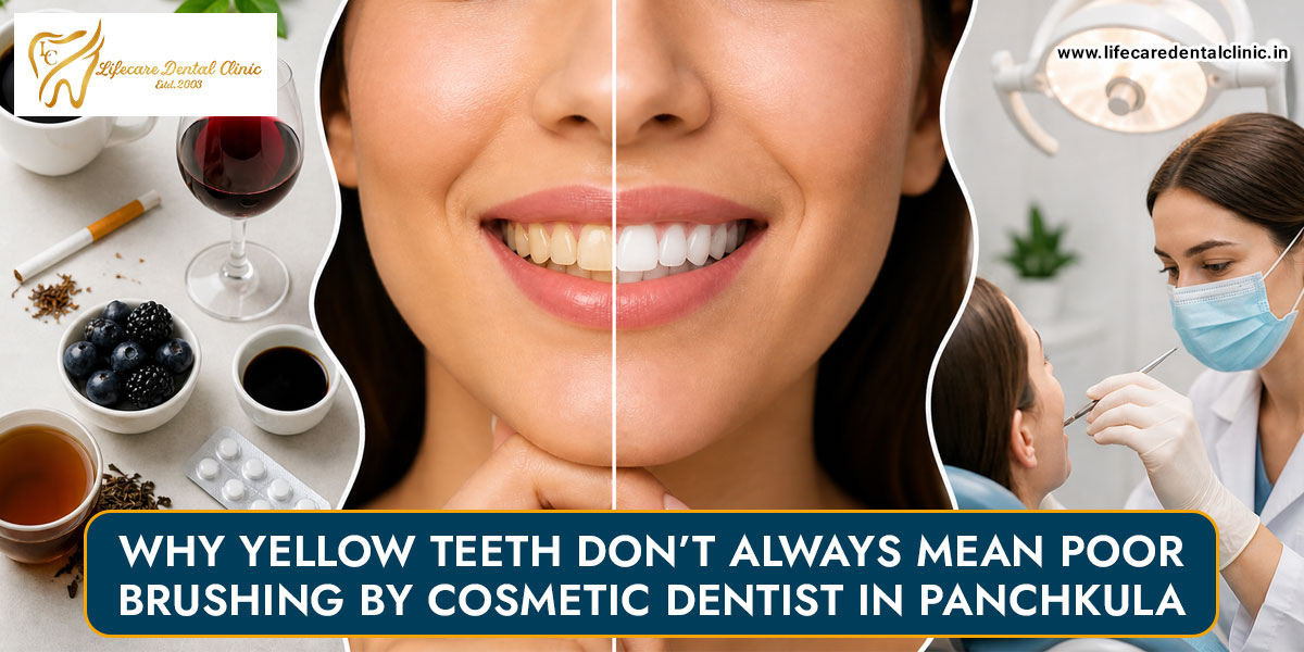 Why-Yellow-Teeth-Don’t-Always-Mean-Poor-Brushing-by-Cosmetic-Dentist-in-Panchkula
