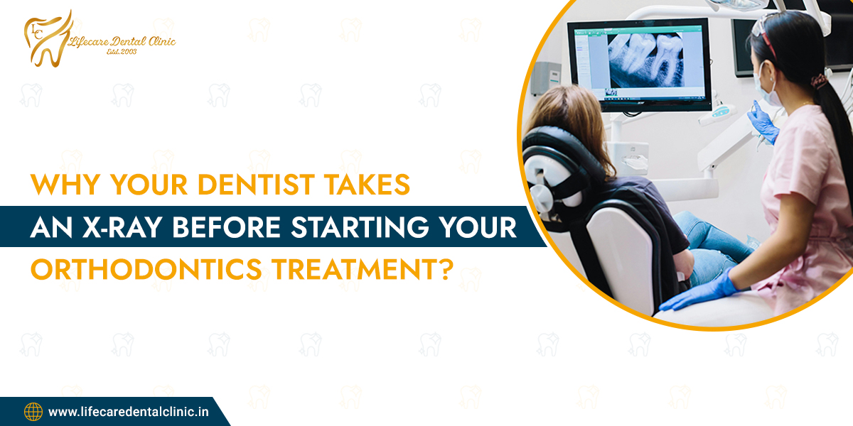 Why-Your-Dentist-Takes-an-X-Ray-Before-Starting-Your-Orthodontics-Treatment