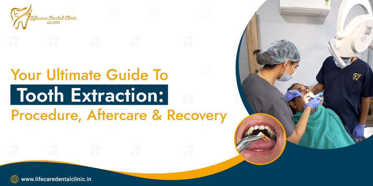 Your-Ultimate-Guide-To-Tooth-Extraction-Procedure-Aftercare--Recovery