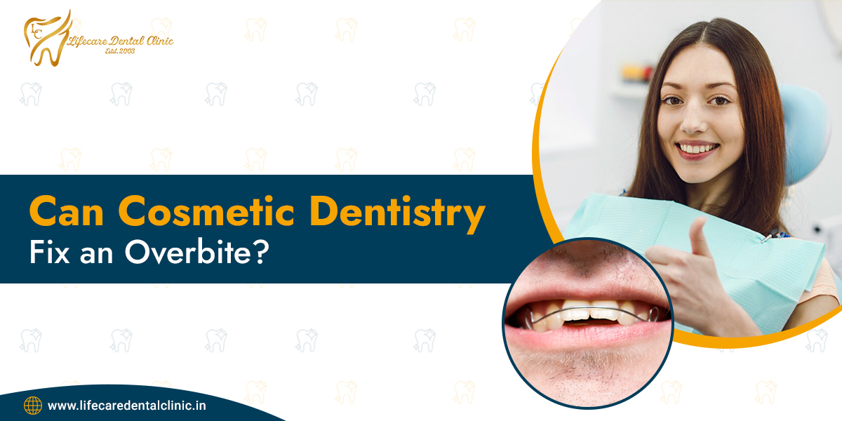 can-cosmetic-dentistry-fix-an-overbite22