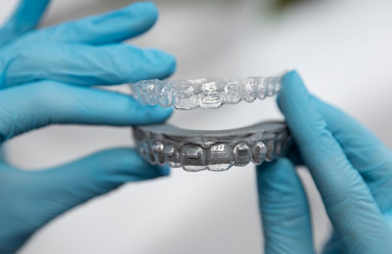 Clear Aligners in Chandigarh